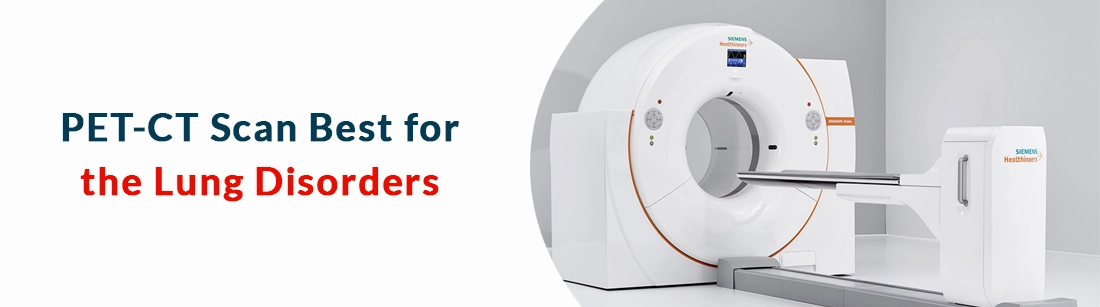 PET-CT Scan as Diagnostic Tool for Lung Disorders, PET-CT Scan Centres ...