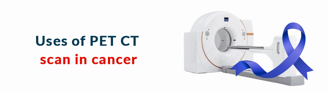 PET CT Scan: Its Uses and Benefits in Cancer | Ganesh Diagnostic