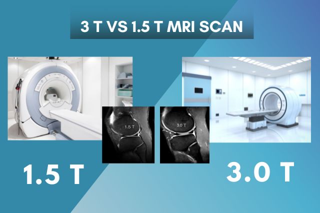 3.0T or 1.5T MRI