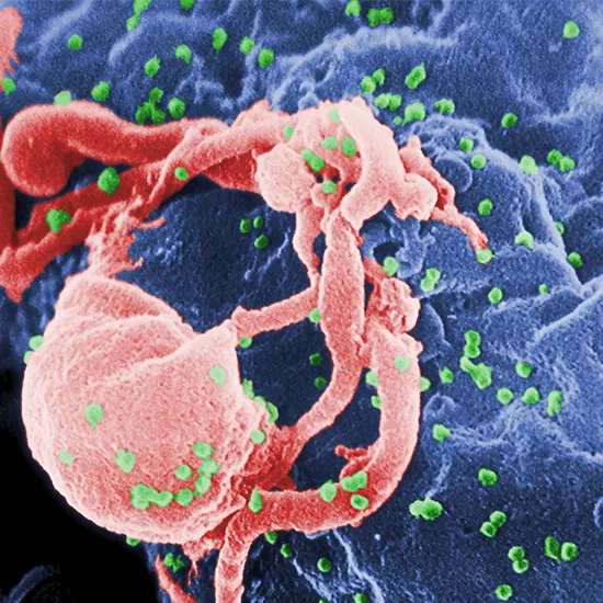 HIV - Causes, Symptoms, Treatment, and Prevention