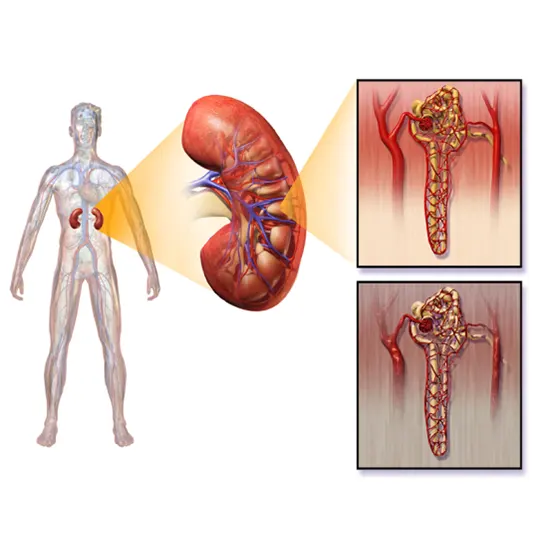 Azotemia - Symptoms, Types, Causes & Diagnosis