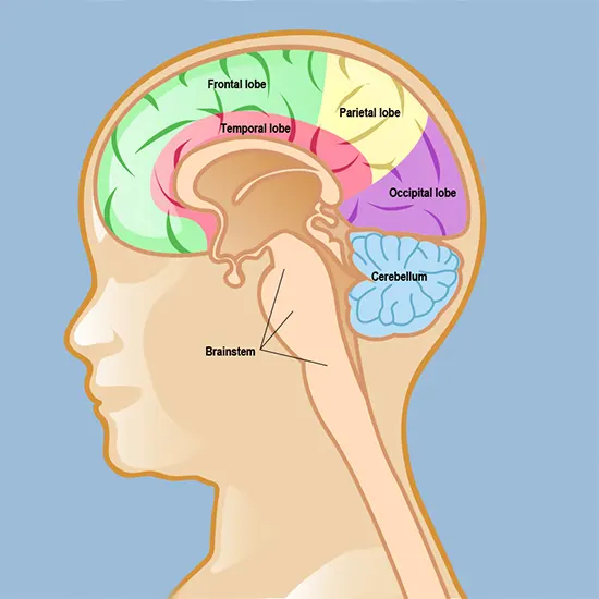 Astrocytoma: Overview, Types, Causes, Diagnosis & Treatment