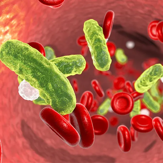 New Study Finds Sepsis Is A Leading Cause Of Global Deaths