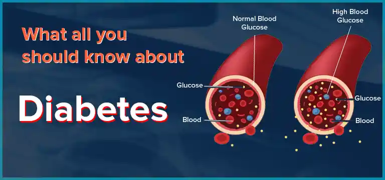 What All You Should Know About - Diabetes