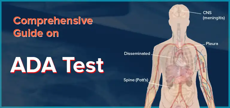 Comprehensive Guide on ADA (Adenosine Deaminase) Test | Ganesh Diagnostic
