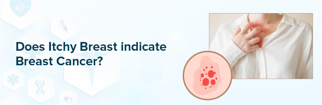 https://www.ganeshdiagnostic.com/admin/public/assets/images/blog/banner/mobile/1708173404-Does%20Itchy%20Breast%20indicate%20Breast%20Cancer.jpg