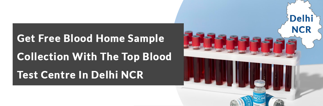 Get Free Blood Home Sample Collection With the Top Blood Test Centre in ...
