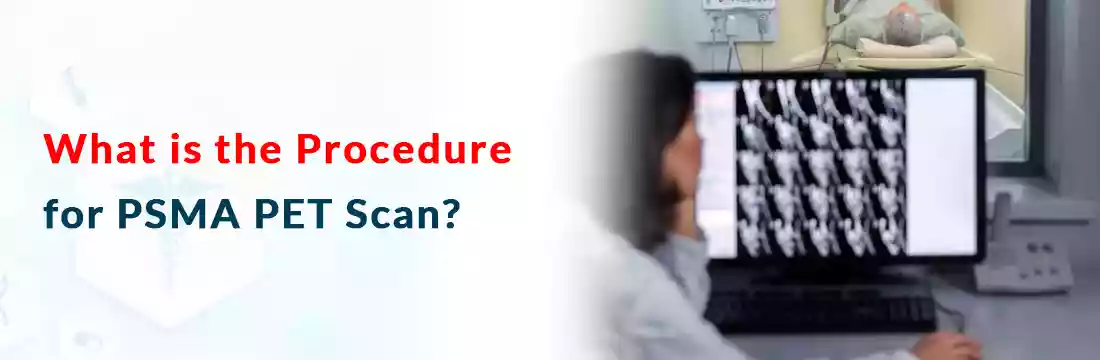 What is the Procedure for PSMA PET Scan? | Ganesh Diagnostic