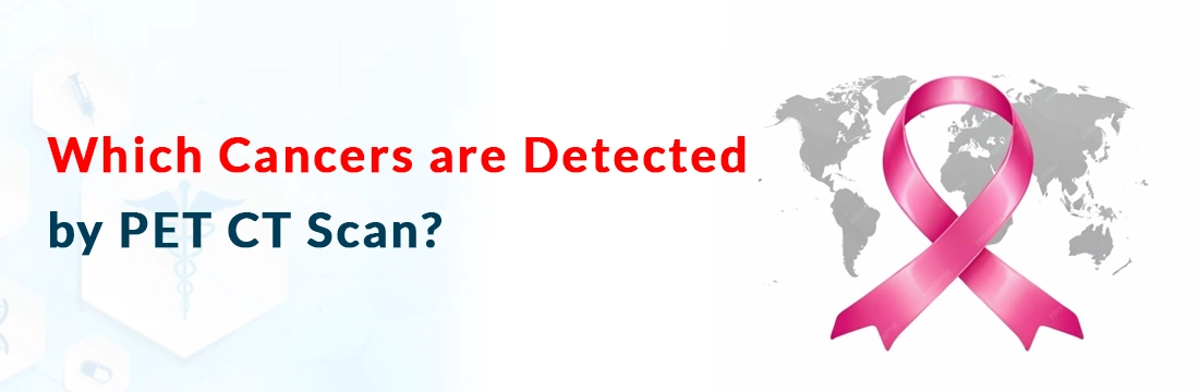 Which Cancers are Detected by PET CT Scan?