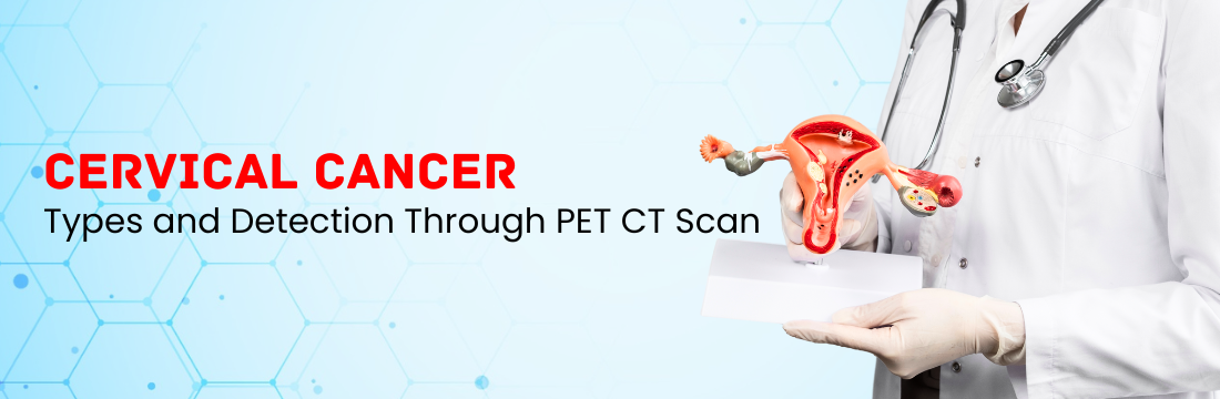 Cervical Cancer Detection Through PET CT Scan | CareBox