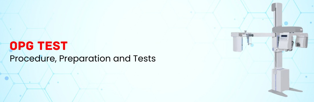 What is the OPG Test? Procedure, Preparation and Tests