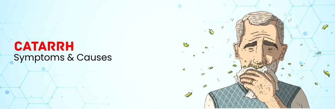 What is Catarrh?: Symptoms, Causes and When to seek medical care?