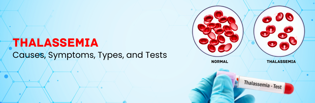 Thalassemia: Causes, Symptoms, Types, and Tests