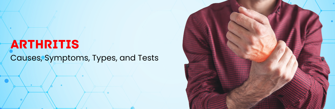 Arthritis: Causes, Symptoms, Types, and Tests