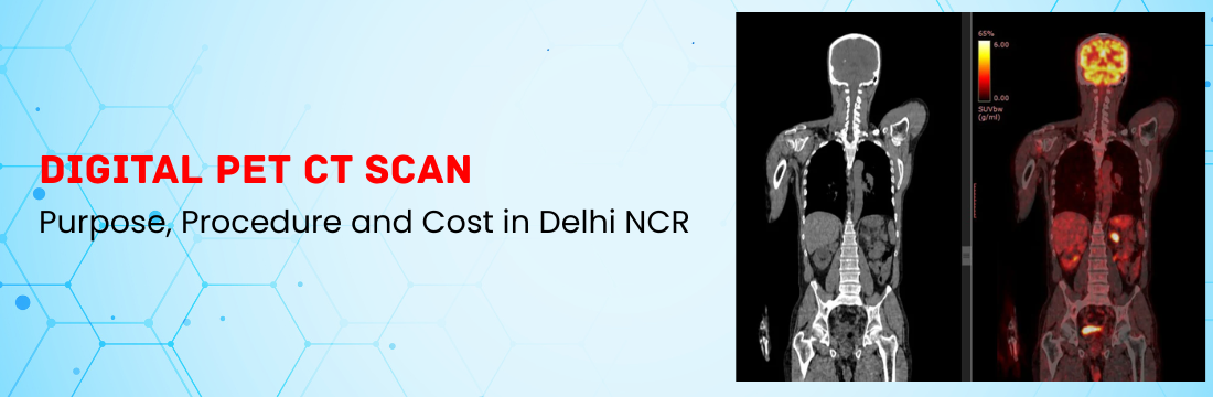 Digital PET CT: Purpose, Procedure and Cost in Delhi NCR