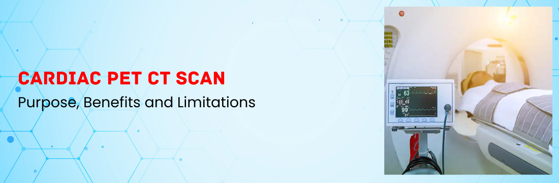 Cardiac PET CT Scan: Purpose, Benefits and Limitations