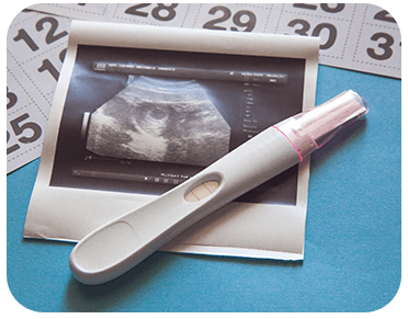 Obstetric Ultrasound Scan