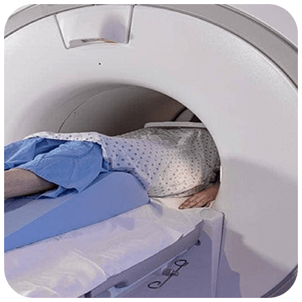 MRI Angiography Left Lower Limb