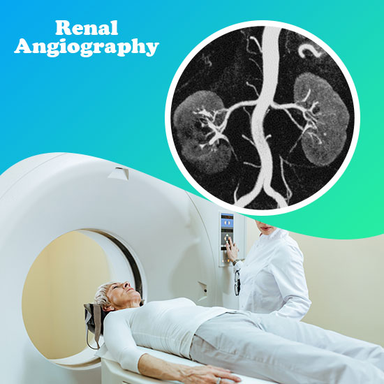 MRI Renal Angiography