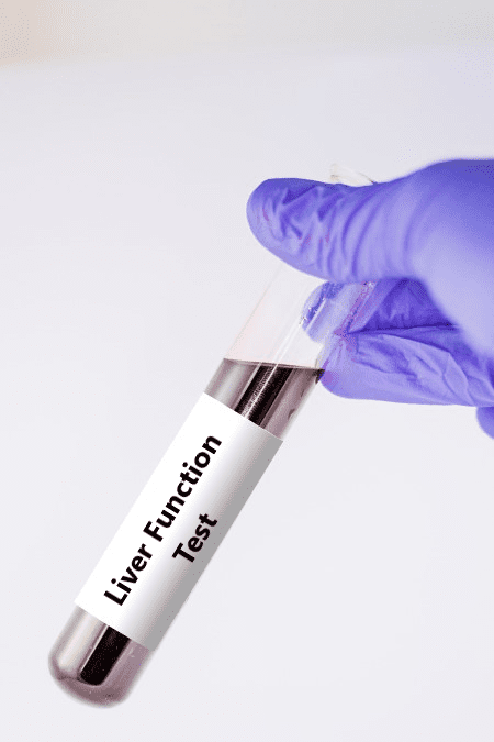Liver Function Test Near Me LFT Test Price Delhi GDIC