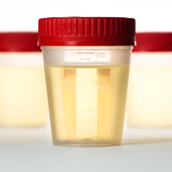 pregnancy test urine test