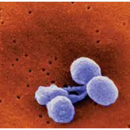 Beta-2 Transferrin | Test Price In Delhi | Cost Near Me, India | Ganesh ...