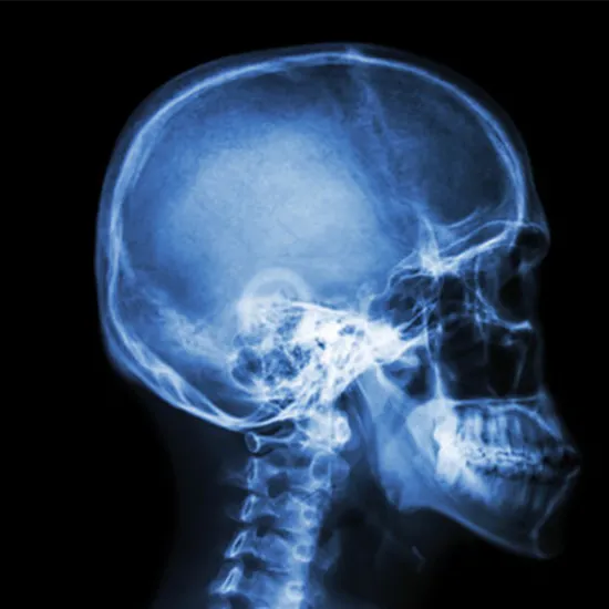 X-ray Head & Neck AP/Lateral