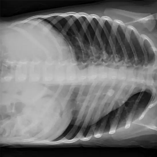 X-ray Chest Decubitus Left