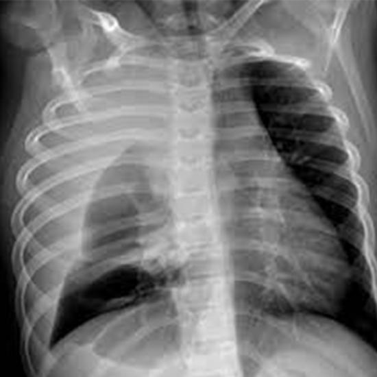 X-Ray Apicogram