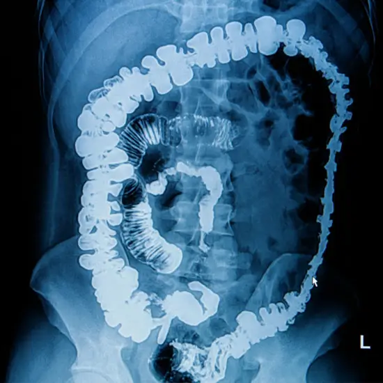X-ray Barium M.F.T.