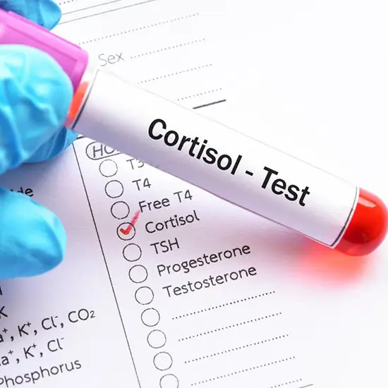 Cortisol Gesundheitstest