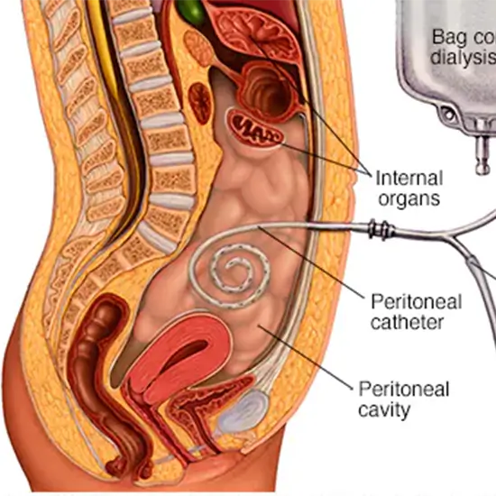 Peritoneal Equilibrium And Adequacy