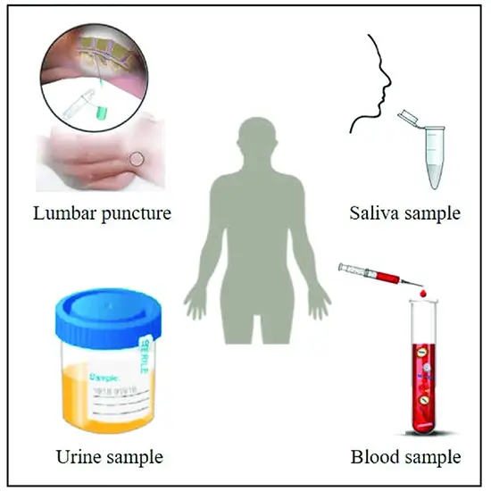 Fluid Examination Routine, Body Fluids | Test Price In Delhi, India | Ganesh Diagnostic