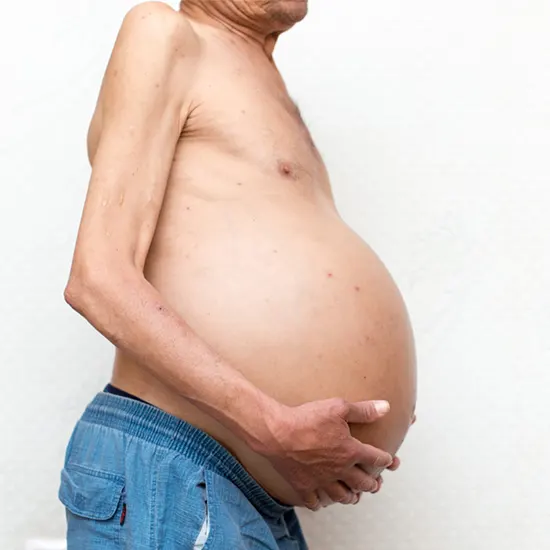 ascites package test