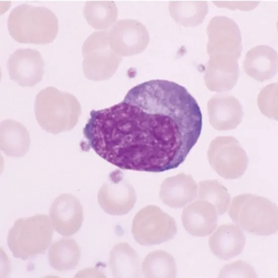 Ehrlichiosis
