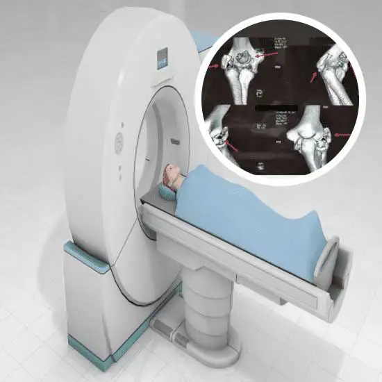 CECT Right Elbow Joint