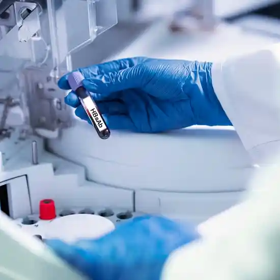 hepatitis b surface antibody test