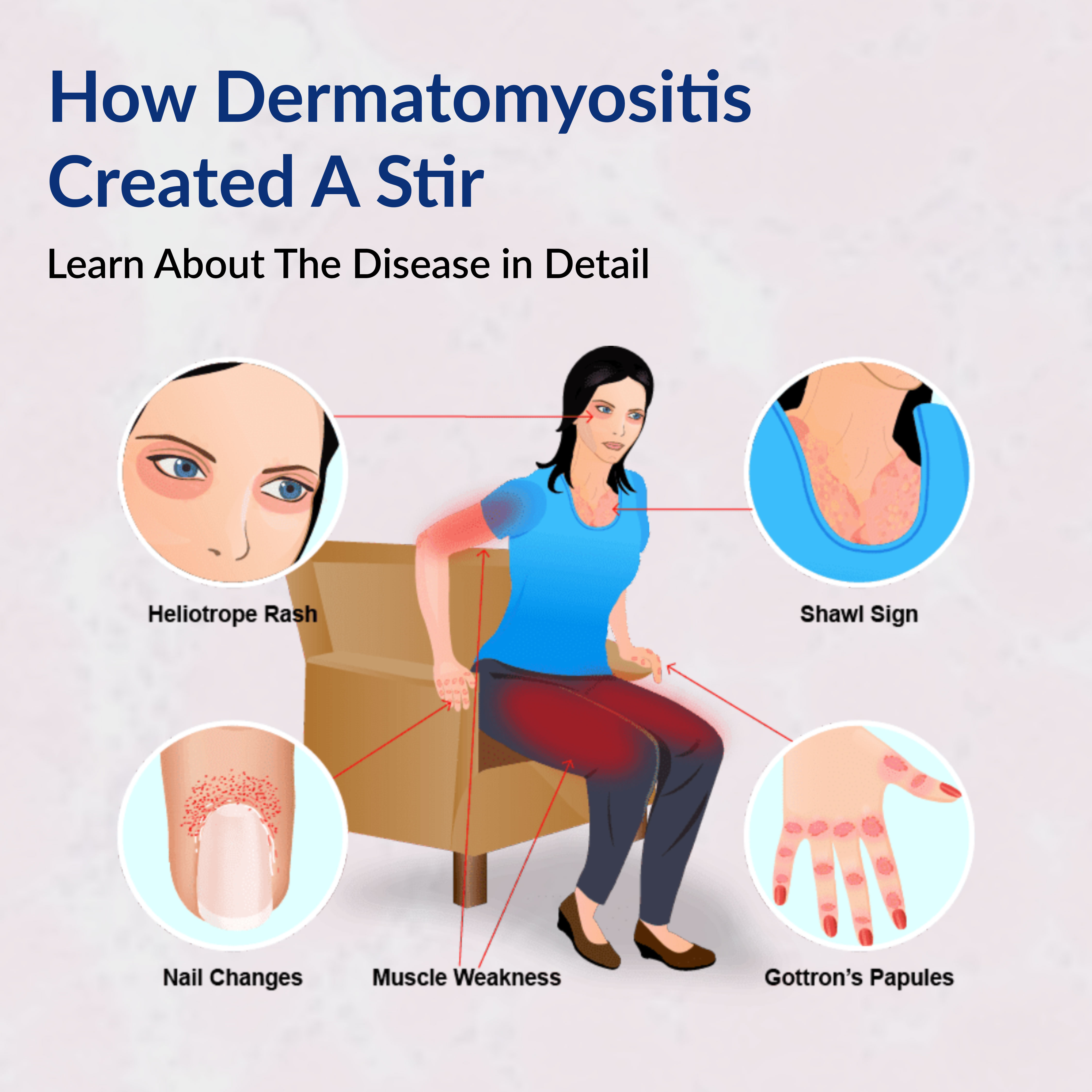 https://www.ganeshdiagnostic.com/admin/public/assets/images/product/1711084886-How-Dermatomyositis-Created-A-Stir-Learn-About-The-Disease-in-Detail.jpg